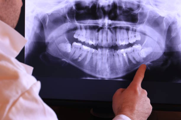 Best Emergency Dental Care for Abscessed Tooth in Lamoni, IA